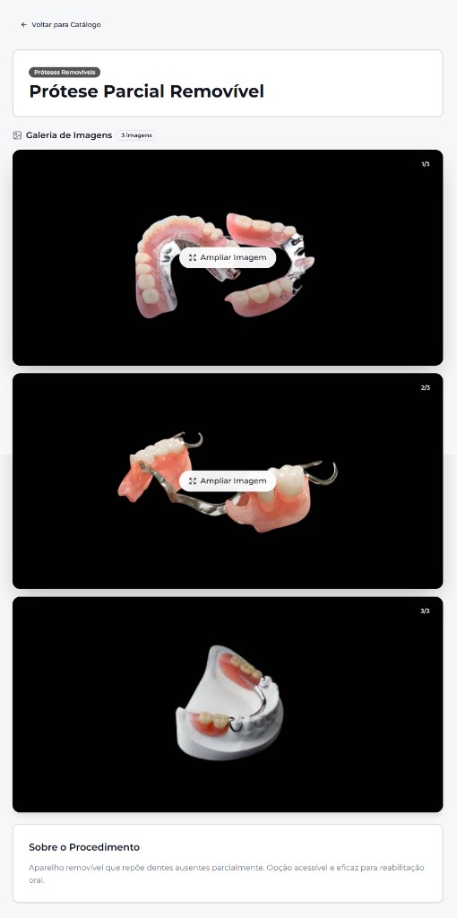 Galeria de imagens do procedimento com múltiplas visualizações